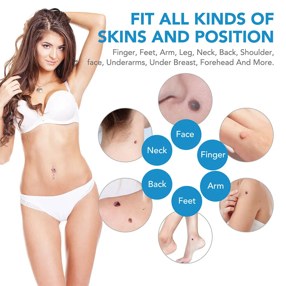 Auto Skin Tag Removal Tool Kit – Luxury Skincare Acne Bewertung und Preis