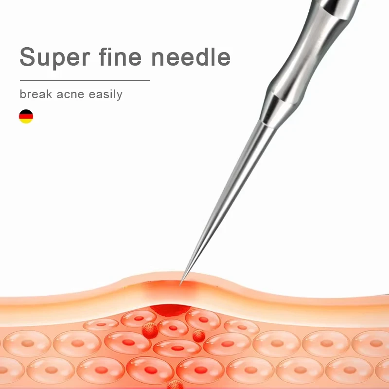 Neues Deutsches Blackhead-Entf – Luxury Skincare Acne Bewertung und Preis