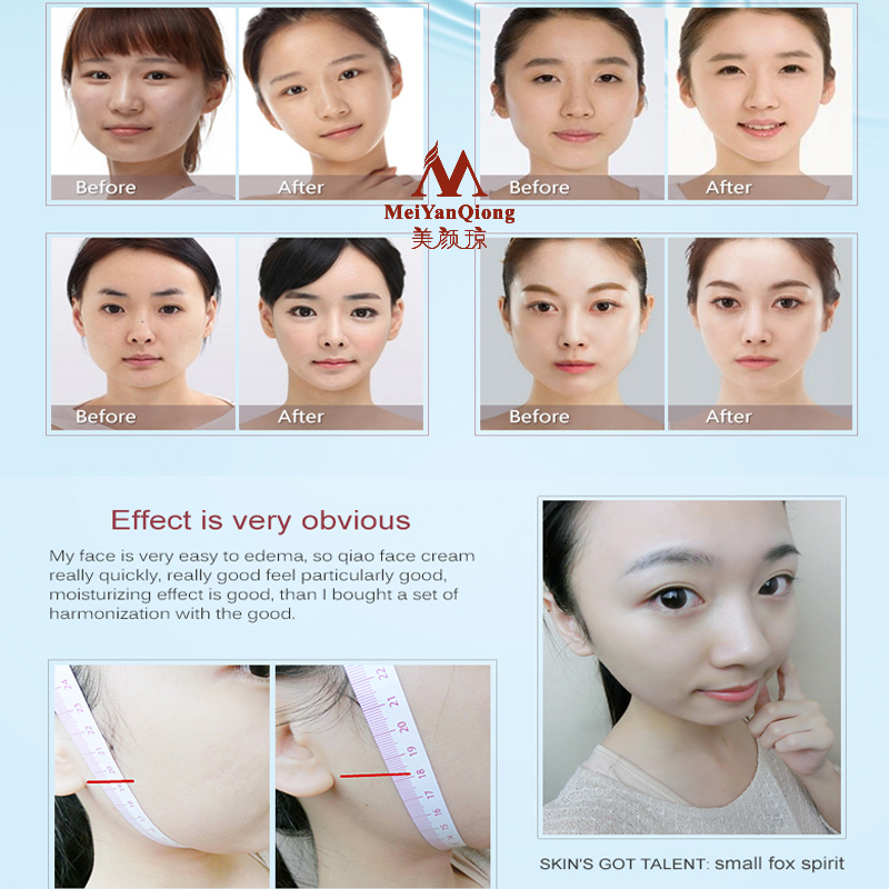 Gesicht Heben Shaping Hautpfle – Luxury Skincare Anti Aging Bewertung und Preis